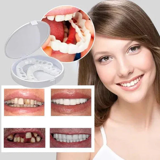 CARILLAS SNAP-ON SMILE – ¡SONRISA NUEVA EN SEGUNDOS!