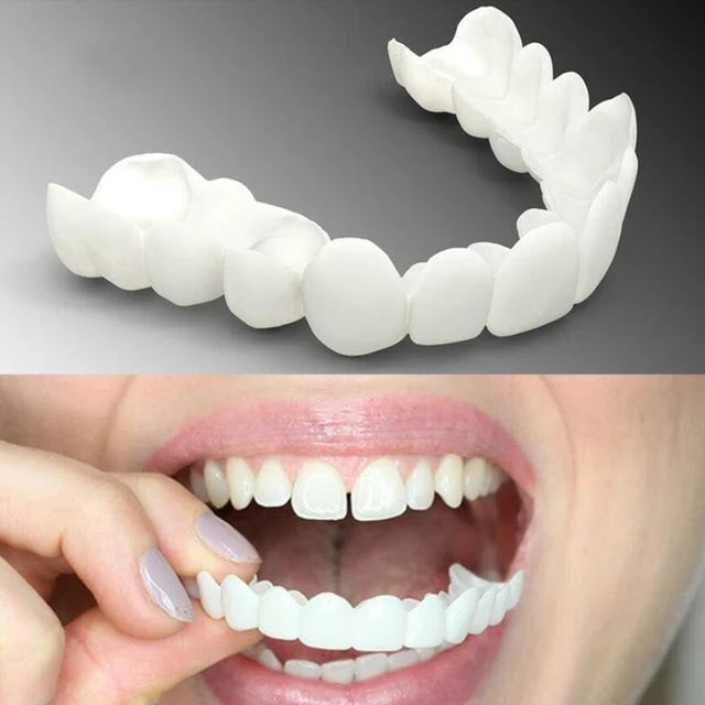 CARILLAS SNAP-ON SMILE – ¡SONRISA NUEVA EN SEGUNDOS!