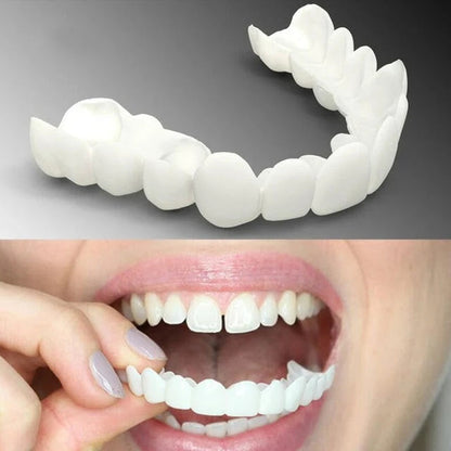 CARILLAS SNAP-ON SMILE – ¡SONRISA NUEVA EN SEGUNDOS!