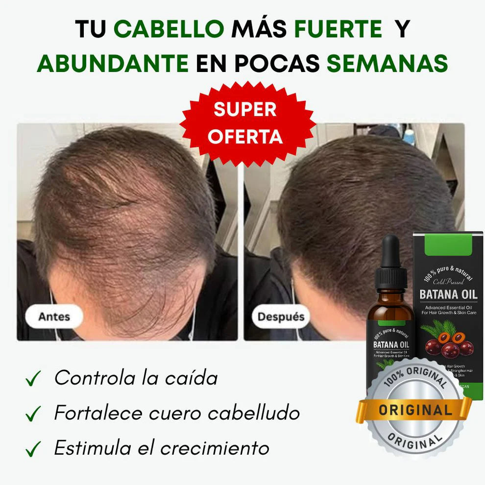 ACEITE DE BATANA